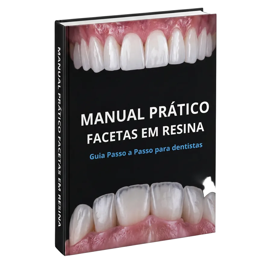 Resin Veneer Clinical Method — digital, print, and video versions