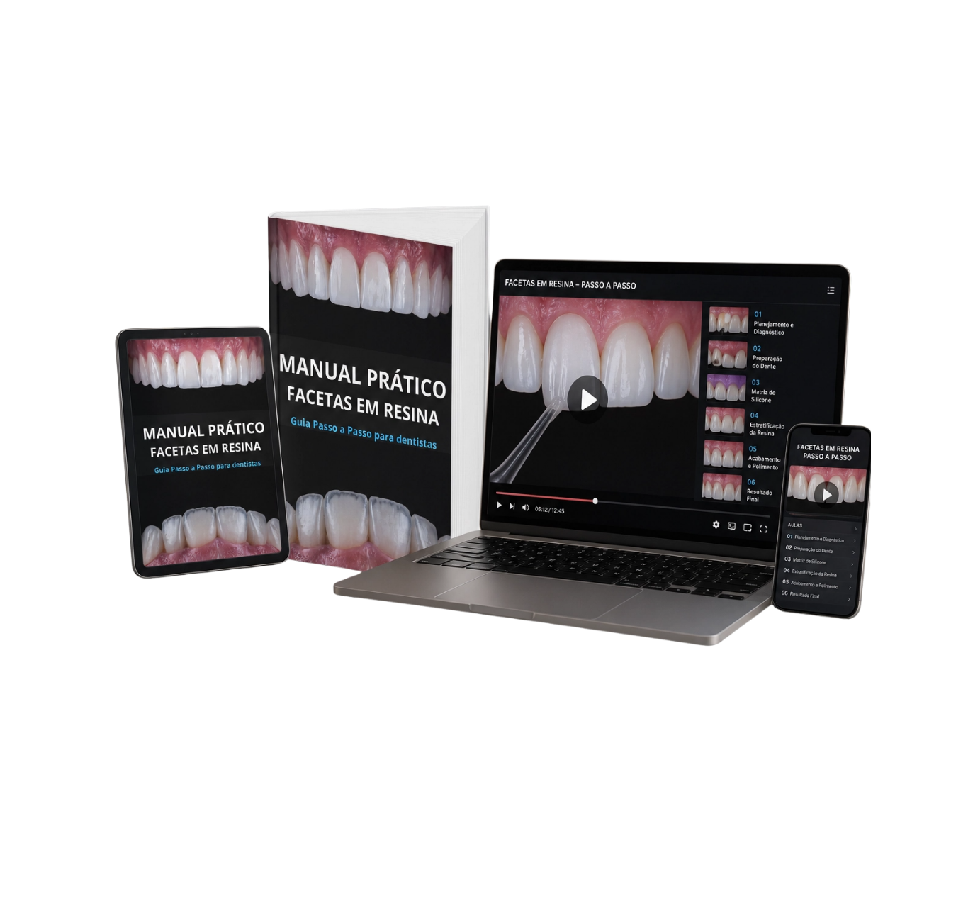 Resin Veneer Clinical Method — print, tablet, laptop, and mobile versions